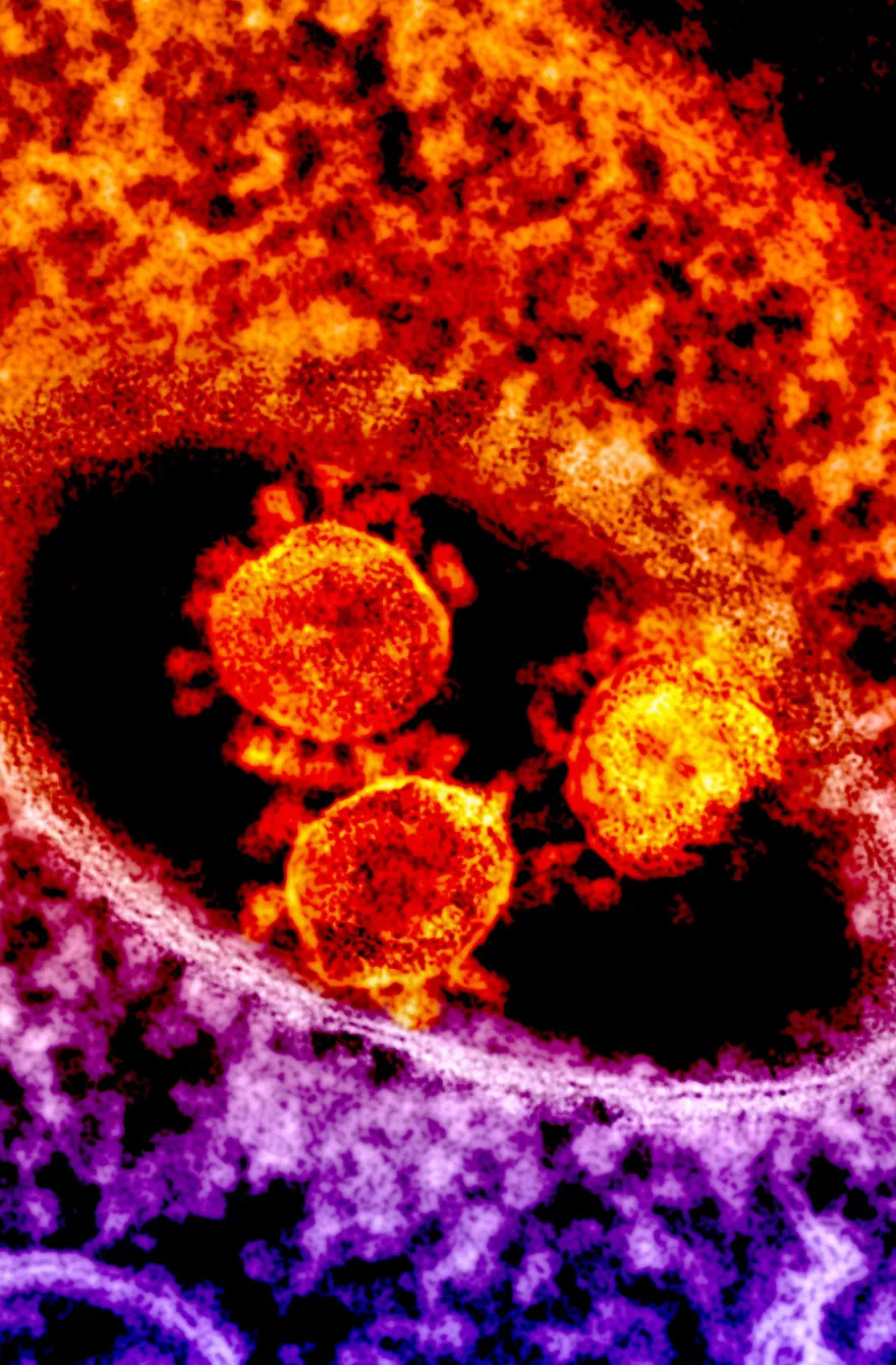 WSI Viewer image cover